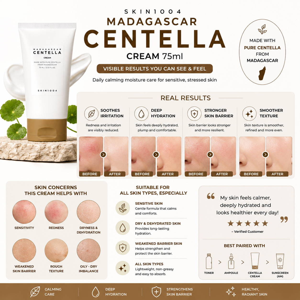 Infographic displaying before and after skin comparison photos and real results for SKIN1004 Madagascar Centella Cream 75ml.