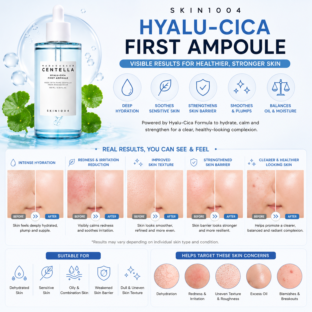 An infographic for SKIN1004 Madagascar Centella Hyalu-Cica First Ampoule displaying before and after clinical skin results alongside a lower section highlighting five targeted skin concerns including dehydration, redness, and uneven texture.