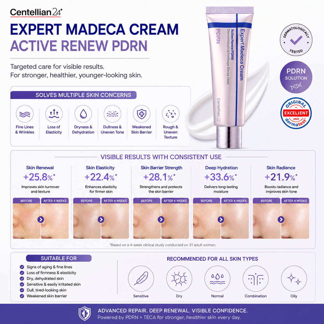 Centellian24 Expert Madeca Cream Active Renew PDRN 50ml targets fine lines wrinkles dryness dullness and weakened skin barrier