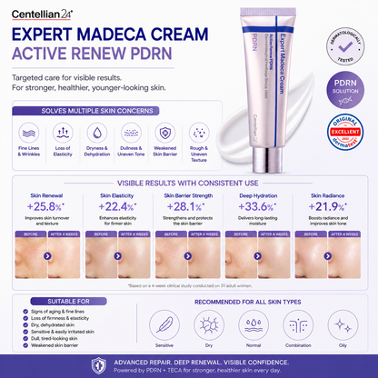 Centellian24 Expert Madeca Cream Active Renew PDRN 50ml targets fine lines wrinkles dryness dullness and weakened skin barrier