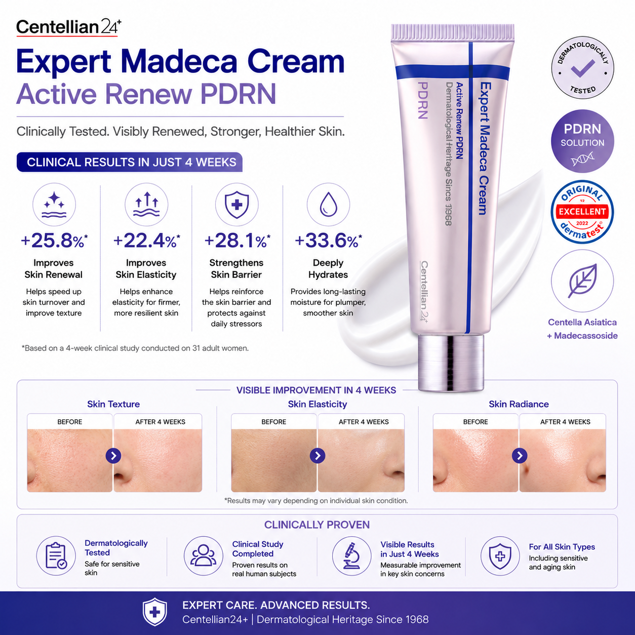 Centellian24 Expert Madeca Cream Active Renew PDRN 50ml clinical skin results showing improved hydration elasticity and barrier strength