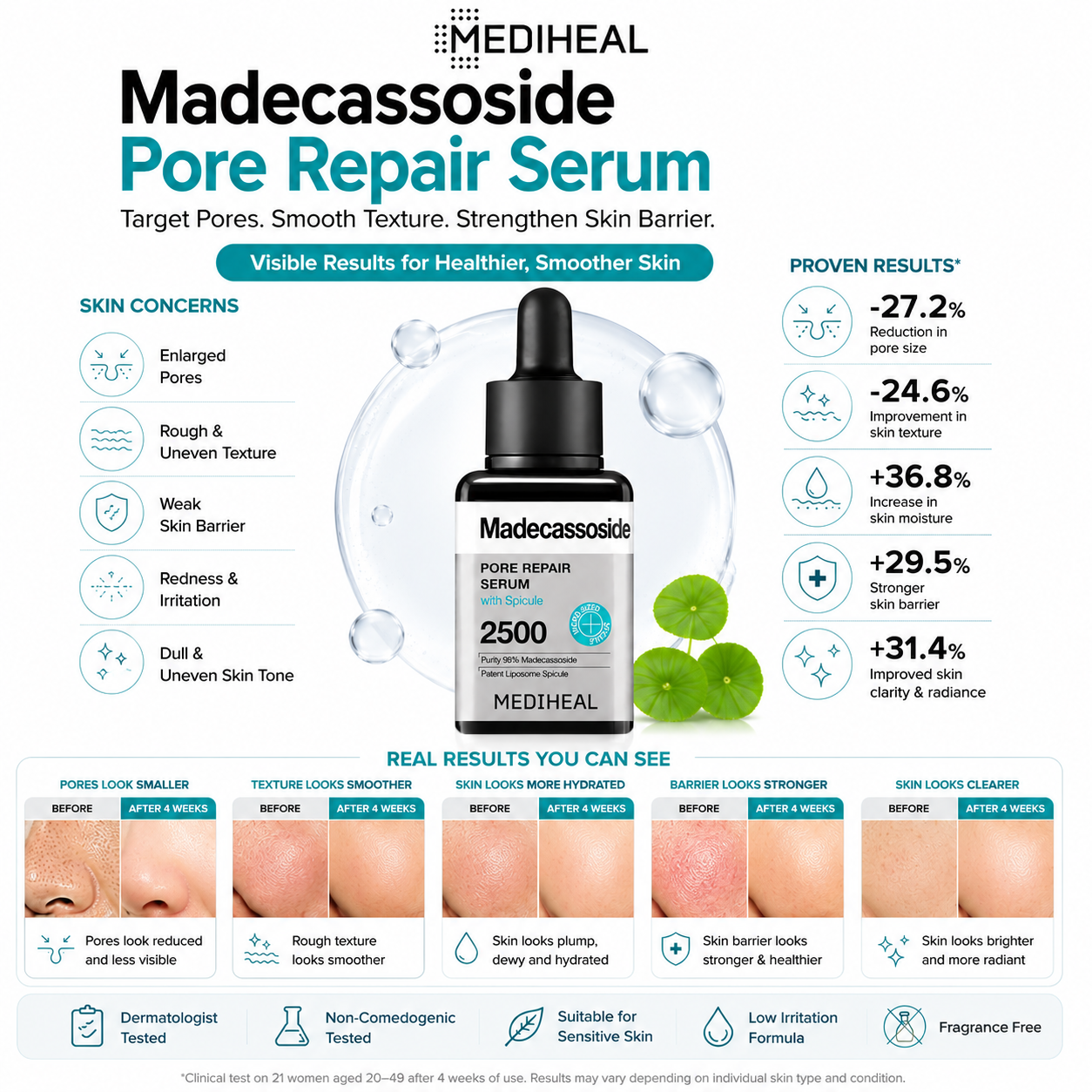 MEDIHEAL Madecassoside Pore Repair Serum for enlarged pores, rough texture, redness, weakened skin barrier and dull skin with visible results