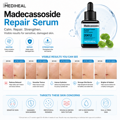 MEDIHEAL Madecassoside Repair Serum skincare infographic for sensitive skin, damaged skin barrier, redness, rough texture, dehydration and dull skin concerns