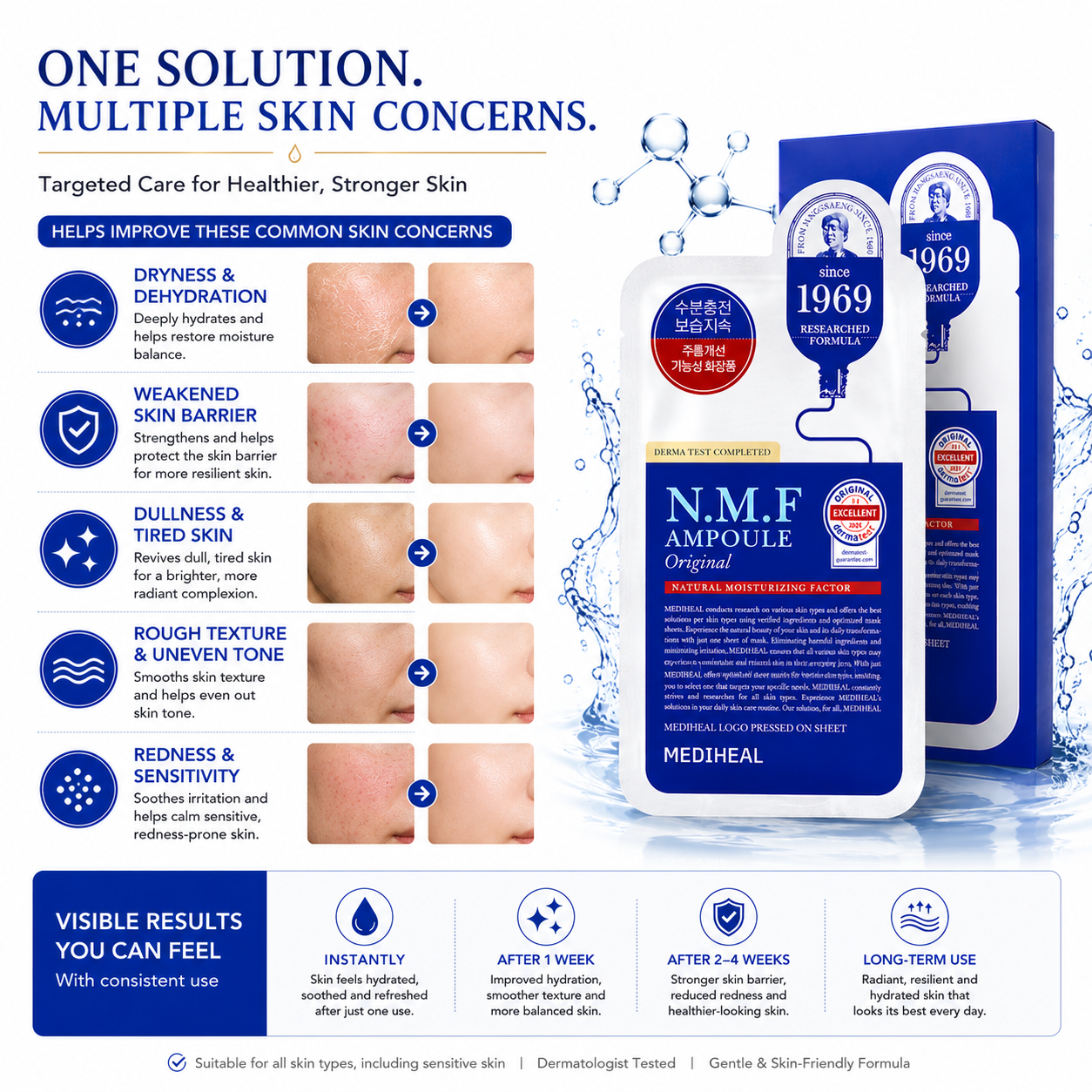 MEDIHEAL N.M.F Ampoule Original Sheet Mask skin concern infographic targeting dryness, dehydration, weakened skin barrier, dullness, rough texture, redness, and sensitive skin with hydration-focused care.