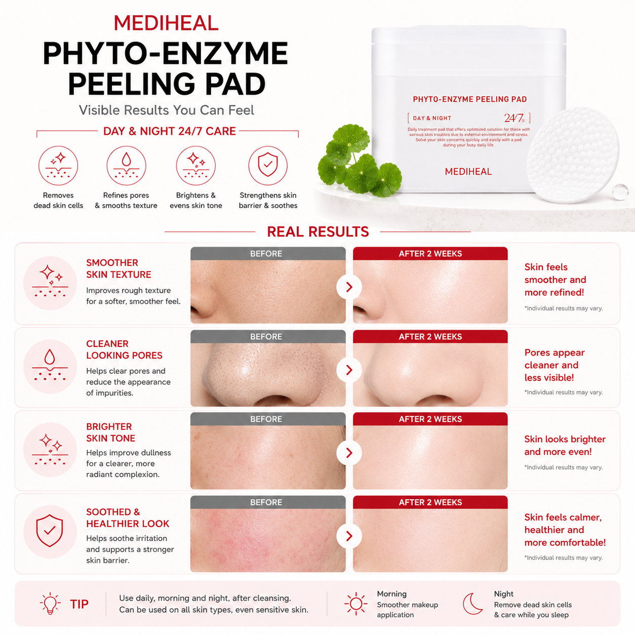MEDIHEAL Phyto-Enzyme Peeling Pad skin results infographic showing smoother skin texture refined pores brighter complexion and healthier looking skin after regular use
