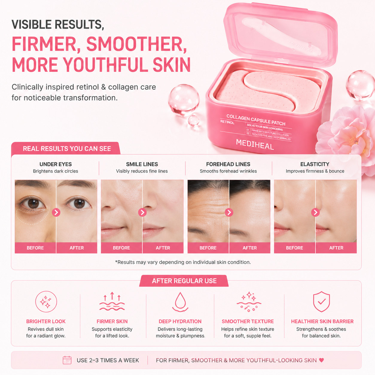 MEDIHEAL Retinol Collagen Capsule Patch results infographic showing improvement in under eye appearance, smile lines, forehead wrinkles and skin elasticity