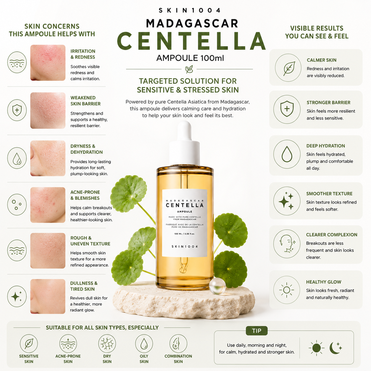 Infographic mapping skin concerns targeted by SKIN1004 Madagascar Centella Ampoule 100ml, including irritation, redness, dryness, and acne-prone skin.