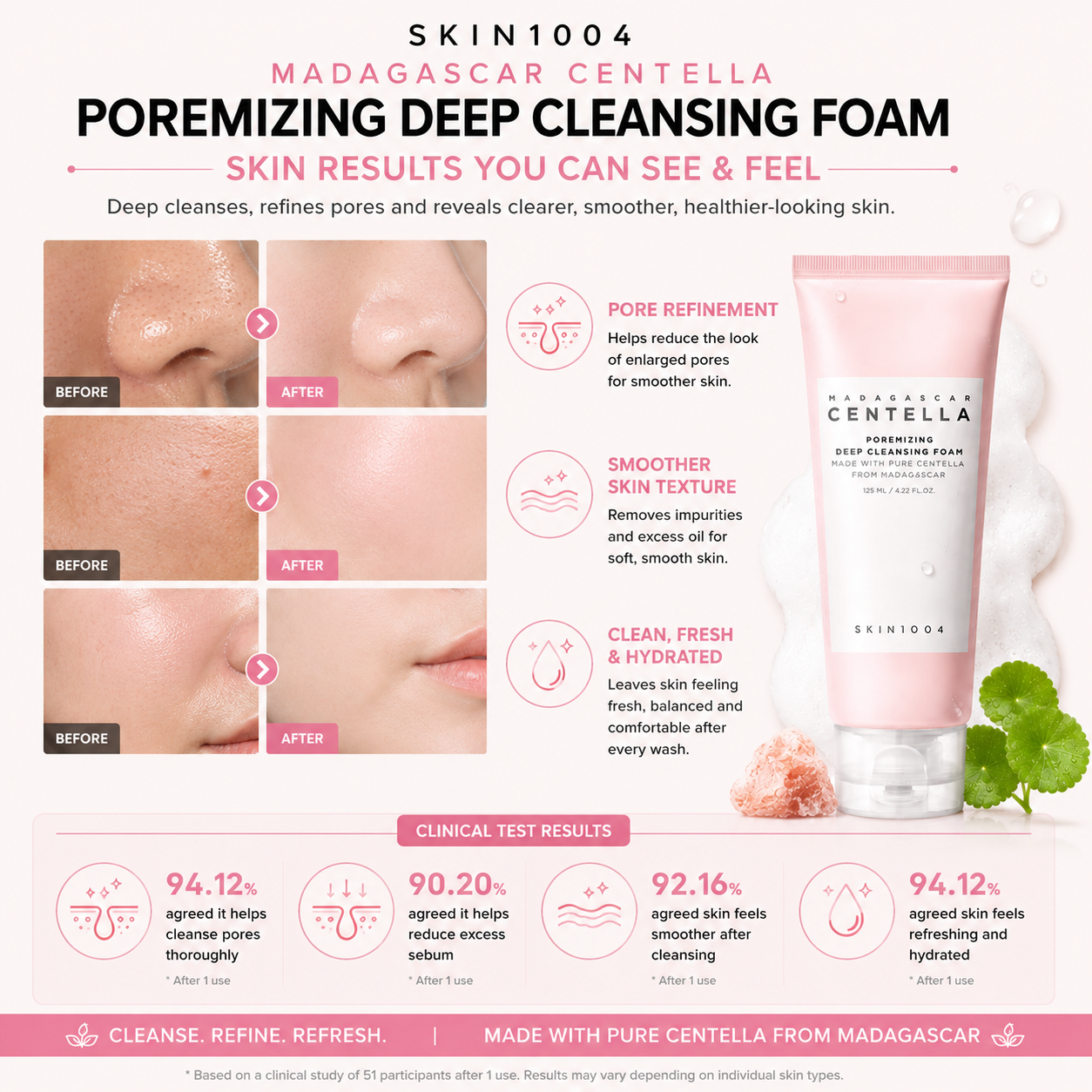 Infographic displaying 1-use clinical study test results and customer skin improvements for SKIN1004 Madagascar Centella Poremizing Deep Cleansing Foam.