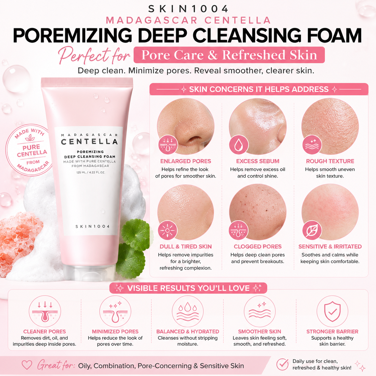 Infographic mapping skin concerns targeted by SKIN1004 Madagascar Centella Poremizing Deep Cleansing Foam, including enlarged pores, excess sebum, rough texture, and clogged pores.
