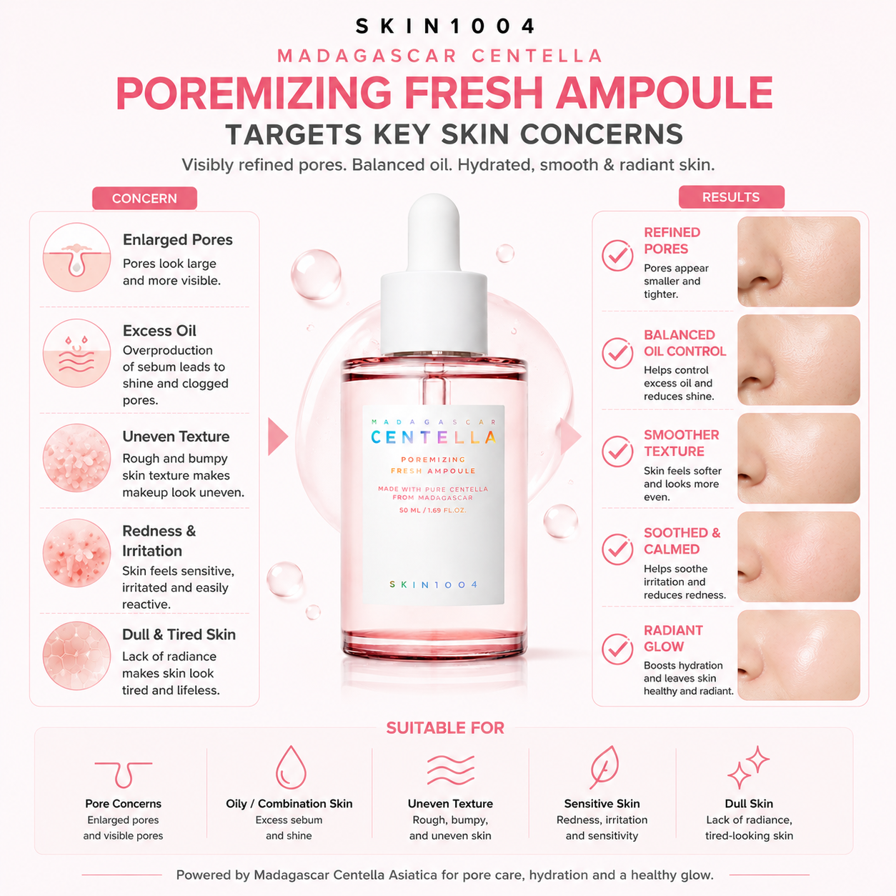 Infographic mapping skin concerns targeted by SKIN1004 Madagascar Centella Poremizing Fresh Ampoule, including enlarged pores, excess oil, uneven texture, and redness.