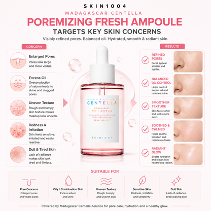 Infographic mapping skin concerns targeted by SKIN1004 Madagascar Centella Poremizing Fresh Ampoule, including enlarged pores, excess oil, uneven texture, and redness.