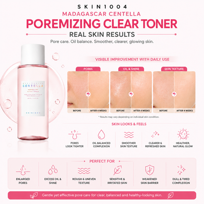 An infographic for SKIN1004 Madagascar Centella Poremizing Clear Toner displaying 4-week before and after skin comparison photos for pores, oil and shine, and skin texture.