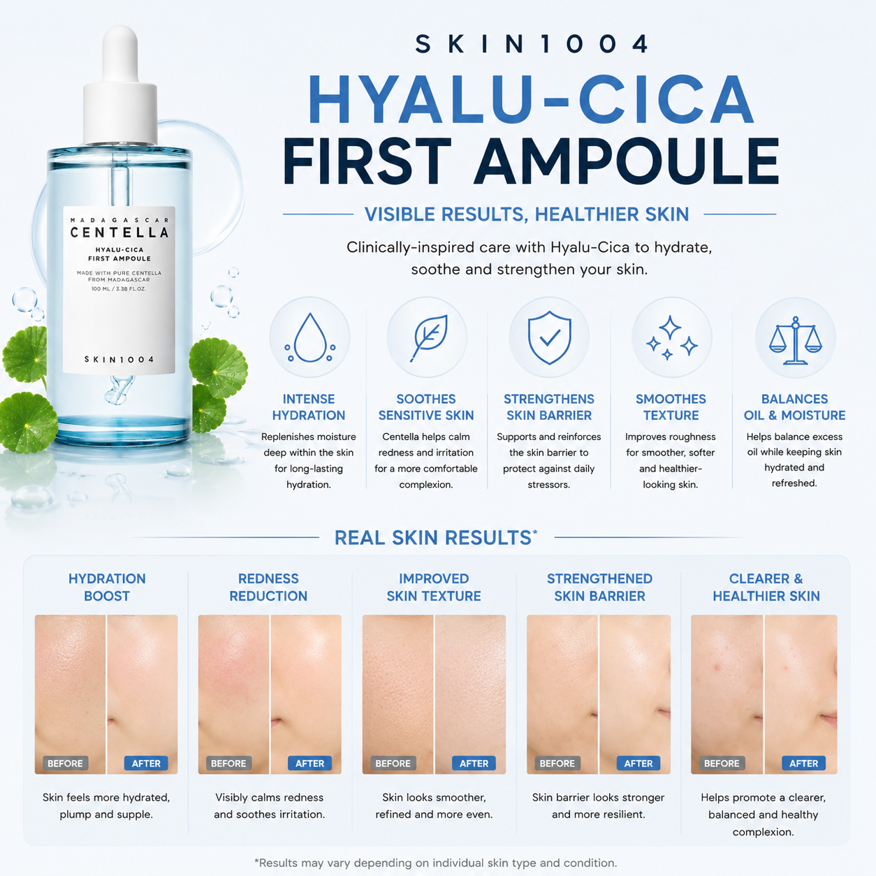 An infographic for SKIN1004 Madagascar Centella Hyalu-Cica First Ampoule displaying five sets of close-up skin photos illustrating before and after results for hydration boost, redness reduction, improved skin texture, a strengthened skin barrier, and clearer skin.