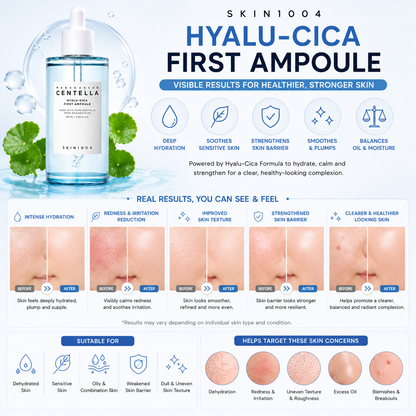 An infographic for SKIN1004 Madagascar Centella Hyalu-Cica First Ampoule displaying before and after clinical skin results alongside a lower section highlighting five targeted skin concerns including dehydration, redness, and uneven texture.