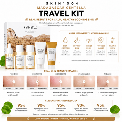 An infographic for the SKIN1004 Madagascar Centella Travel Kit showcasing 2-week before and after clinical skin transformation results for pore care, skin texture, redness care, hydration level, and radiance, alongside consumer survey statistics at the bottom.