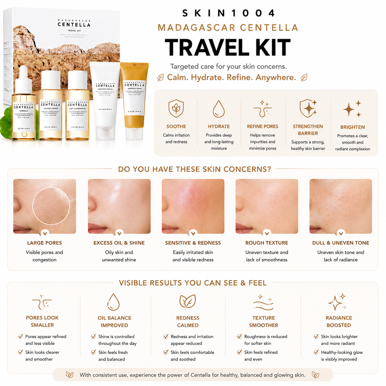 An educational infographic for the SKIN1004 Madagascar Centella Travel Kit detailing five targeted skin concerns including large pores, excess oil, and redness, paired with expected visible results like improved oil balance and boosted radiance at the bottom.