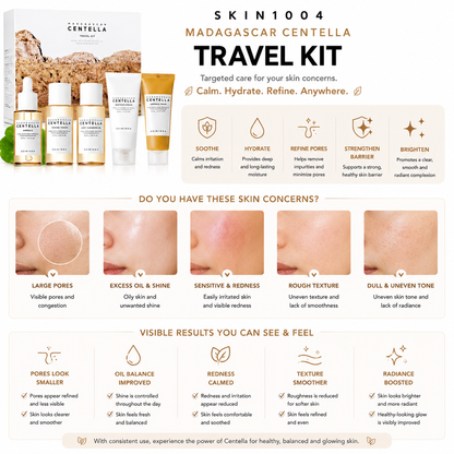 An educational infographic for the SKIN1004 Madagascar Centella Travel Kit detailing five targeted skin concerns including large pores, excess oil, and redness, paired with expected visible results like improved oil balance and boosted radiance at the bottom.