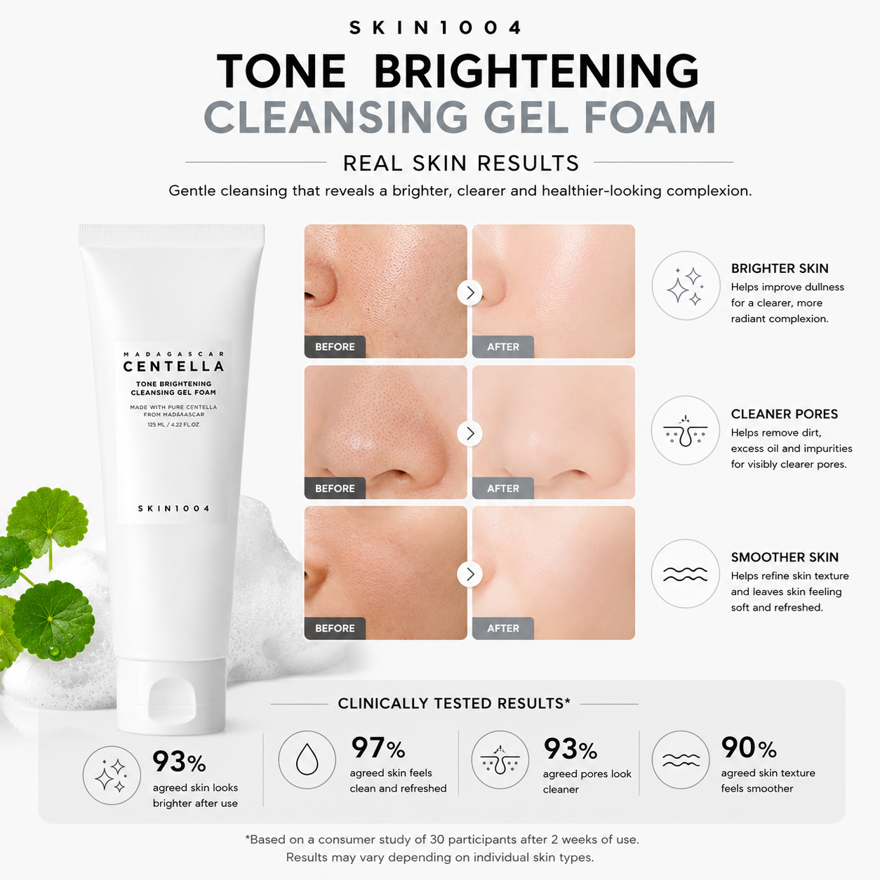 An infographic for SKIN1004 Madagascar Centella Tone Brightening Cleansing Gel Foam displaying three sets of before and after skin comparison photos for brighter skin, cleaner pores, and smoother skin, with clinically tested consumer results percentages at the bottom.